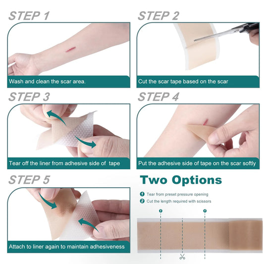 Silicone Scar Sheets (1.6"x 79" Roll-2M), Silicone Scar Tape for Scar Removal Treatment